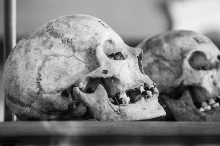skull